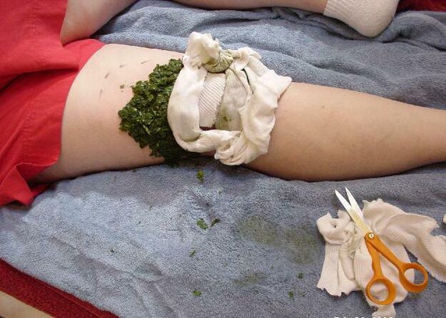 A warm compress made of crushed cabbage leaves on an inflamed knee joint with arthrosis